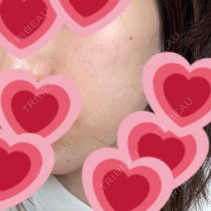 ルラ美容クリニック ルラ美容クリニック 千葉院 / ルラスキンクリニック 千葉院口コミ