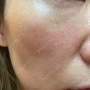 ルラ美容クリニック ルラ美容クリニック 横浜院口コミ