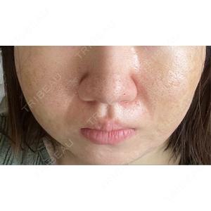 CLEAN BEAUTY CLINICの口コミ