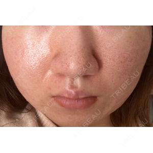 CLEAN BEAUTY CLINICの口コミ
