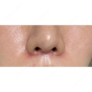 PRISM Beauty Clinic  PRISM Beauty Clinic 町田院口コミ