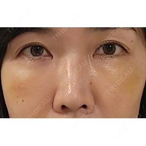 NARU Beauty Clinic NARU Beauty Clinic 【ナルクリ】口コミ
