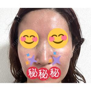 NARU Beauty Clinic NARU Beauty Clinic 【ナルクリ】口コミ