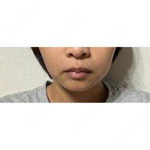 DMTC CLINIC DMTC美容皮膚科 大宮院口コミ