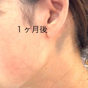 共立美容外科・歯科 共立美容外科 神戸三宮院口コミ