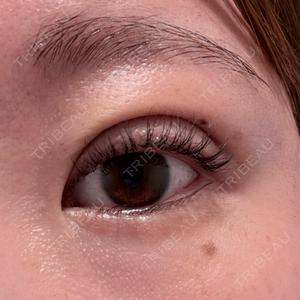 NARU Beauty Clinic NARU Beauty Clinic 【ナルクリ】口コミ