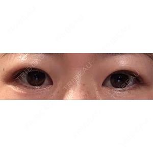 NARU Beauty Clinic NARU Beauty Clinic 【ナルクリ】口コミ