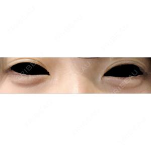 LUHO（ルホ）美容外科口コミ