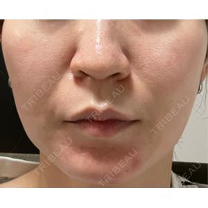 Natural Skin Clinic Natural Skin Clinic 自由ヶ丘院口コミ