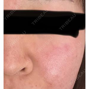 Fellez Clinic【フェルズクリニック】口コミ