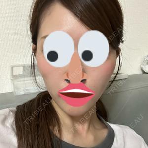口コミ