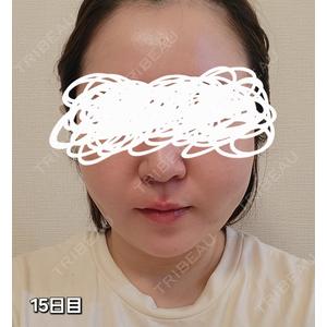 Lipo Clinic omotesandoの