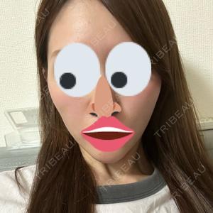 口コミ