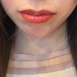 ルラ美容クリニック ルラ美容クリニック 横浜院口コミ