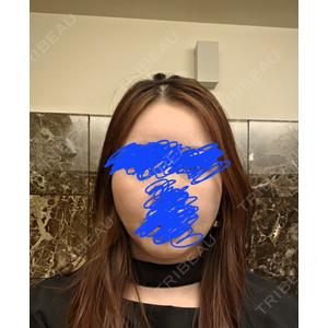 銀座TMクリニック口コミ