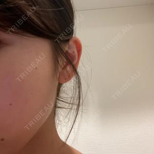 AYANAフィラーズクリニック AYANAフィラーズクリニック 渋谷院口コミ