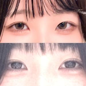 口コミ