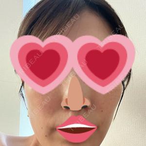 Chloe Cheongdam Clinic （クロエチョンダムクリニック）口コミ