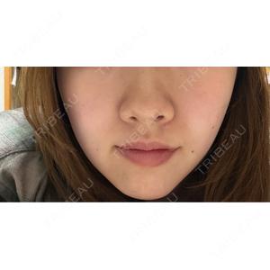 口コミ