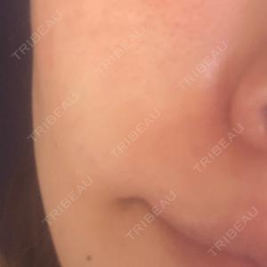 TCB東京中央美容外科 TCB東京中央美容外科 広島院口コミ