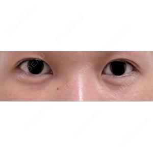 AYANAフィラーズクリニック AYANAフィラーズクリニック 渋谷院口コミ