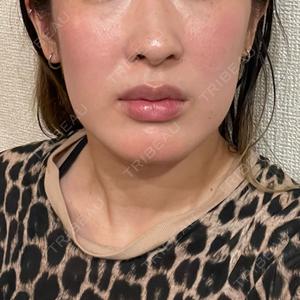 口コミ