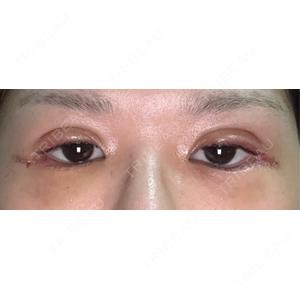 湘南美容クリニック 湘南美容クリニック 千葉センシティ院口コミ