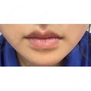 麻布十番クレールデンタルクリニック口コミ