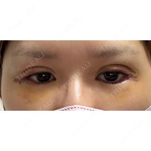 湘南美容クリニック 湘南美容クリニック 千葉センシティ院口コミ