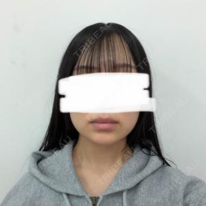 DMTC CLINIC DMTC美容皮膚科 大宮院口コミ
