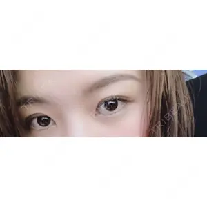蘇春堂形成外科口コミ
