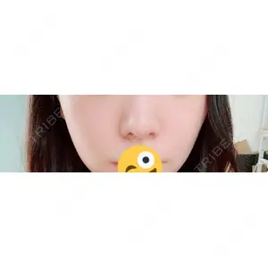 口コミ
