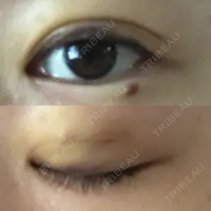 共立美容外科・歯科 共立美容外科 渋谷院口コミ