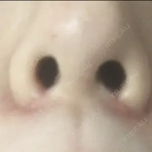 プラストクリニック口コミ