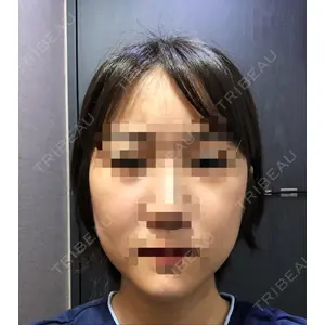 id美容外科の口コミ