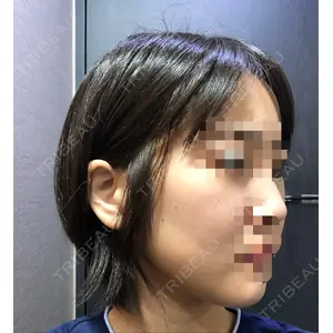 id美容外科の口コミ