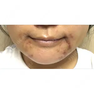 現代美学整形外科口コミ