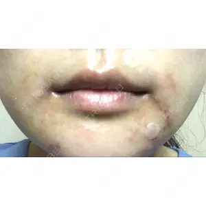 現代美学整形外科口コミ