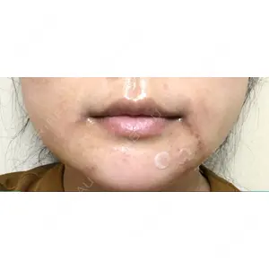 現代美学整形外科口コミ