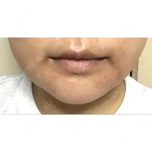 現代美学整形外科口コミ