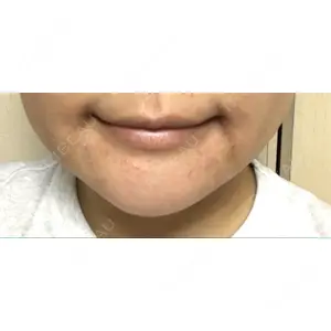 現代美学整形外科口コミ