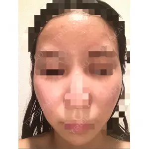フレッシュ整形外科口コミ