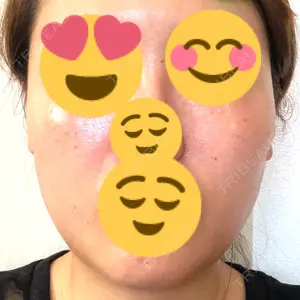 聖心美容クリニック グループ 聖心美容クリニック 広島院口コミ