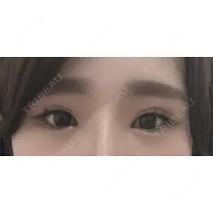 TCB東京中央美容外科 TCB東京中央美容外科 中野院口コミ