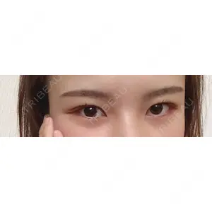 蘇春堂形成外科口コミ