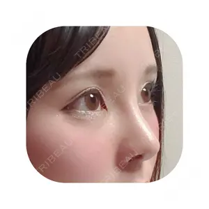 ソウルクイーン整形外科（旧コエンミ整形外科）口コミ