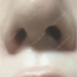 プラストクリニック口コミ