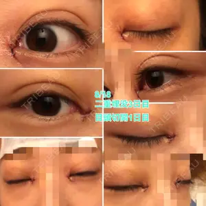 TCB東京中央美容外科 TCB東京中央美容外科 中野院口コミ