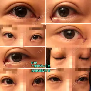 TCB東京中央美容外科 TCB東京中央美容外科 中野院口コミ