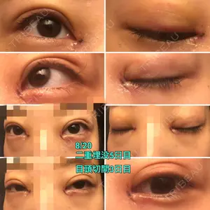 TCB東京中央美容外科 TCB東京中央美容外科 中野院口コミ